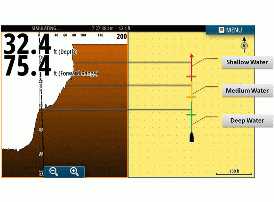 ForwardScan™ transducer   Painestore